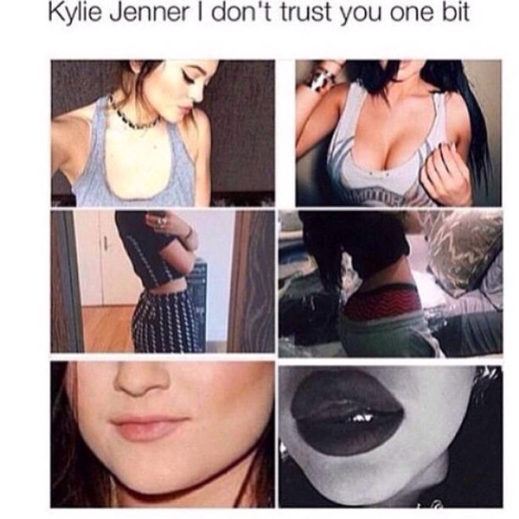 Kylie Jenner implants