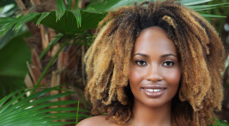 Afro Braids Baldness