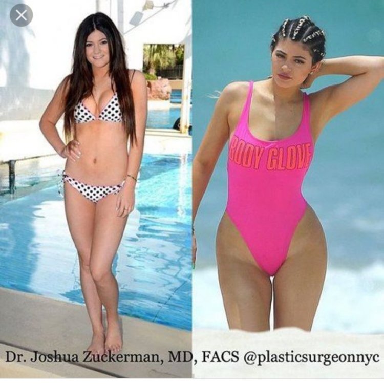 Kylie Jenner Body Before and After