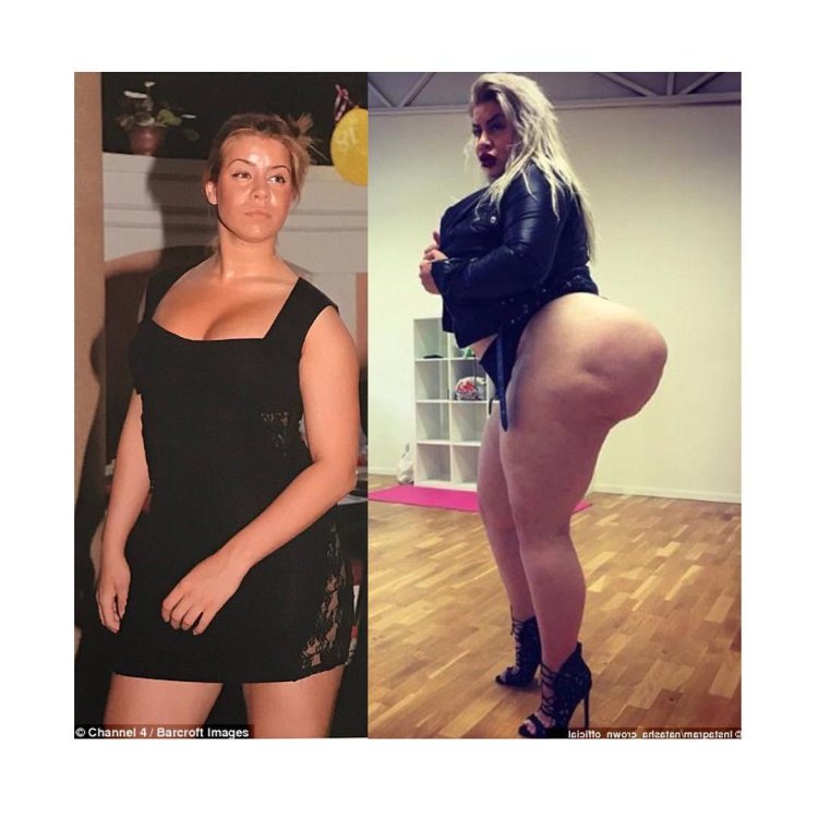 NATASHA CROWN before surgery