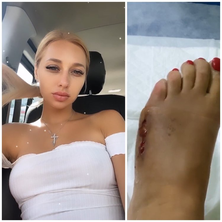 Anastasia stuck her legs