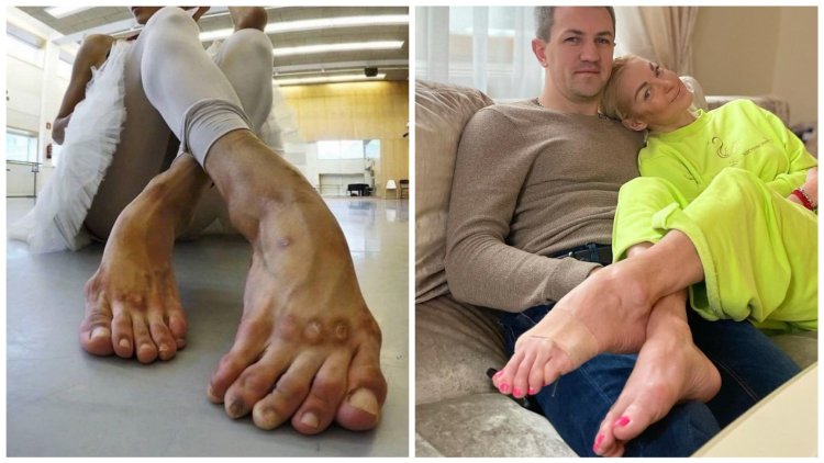 Anastasia Volochkova foot