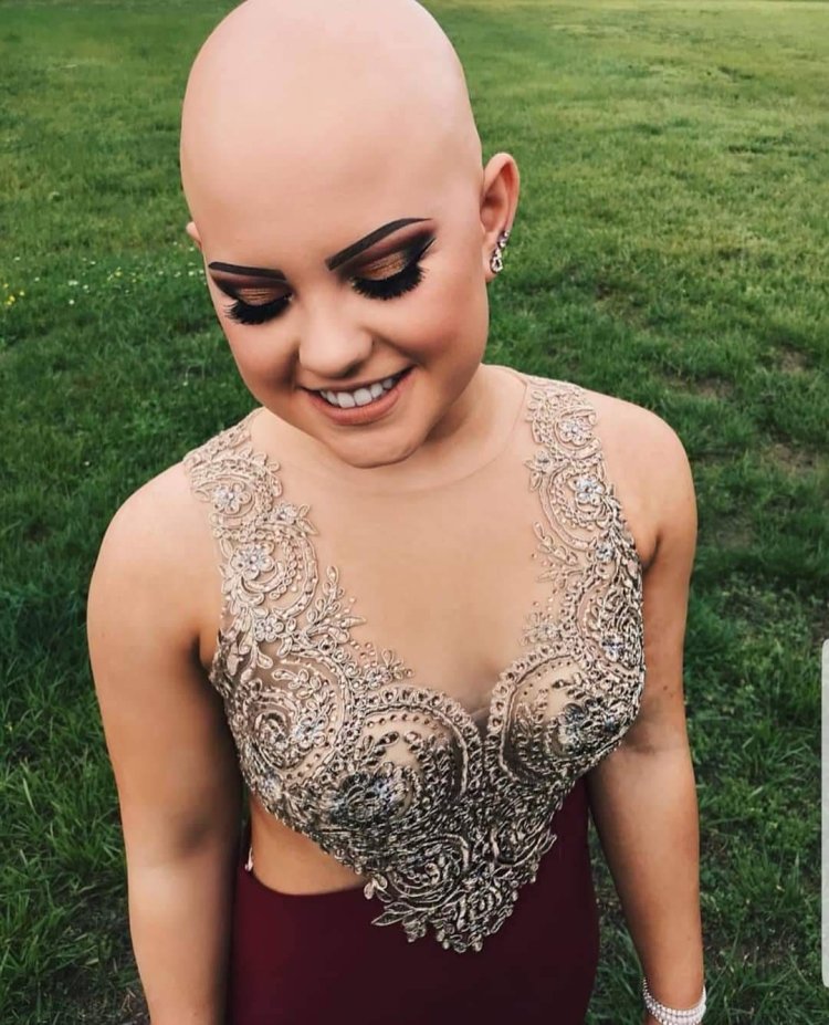 Bald girls are terrible