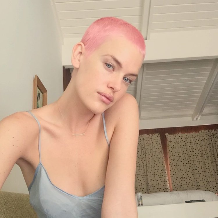 Bald girl with pink hair