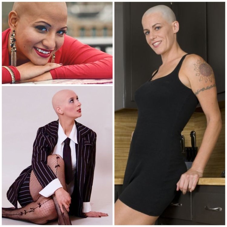 Bald is better in women