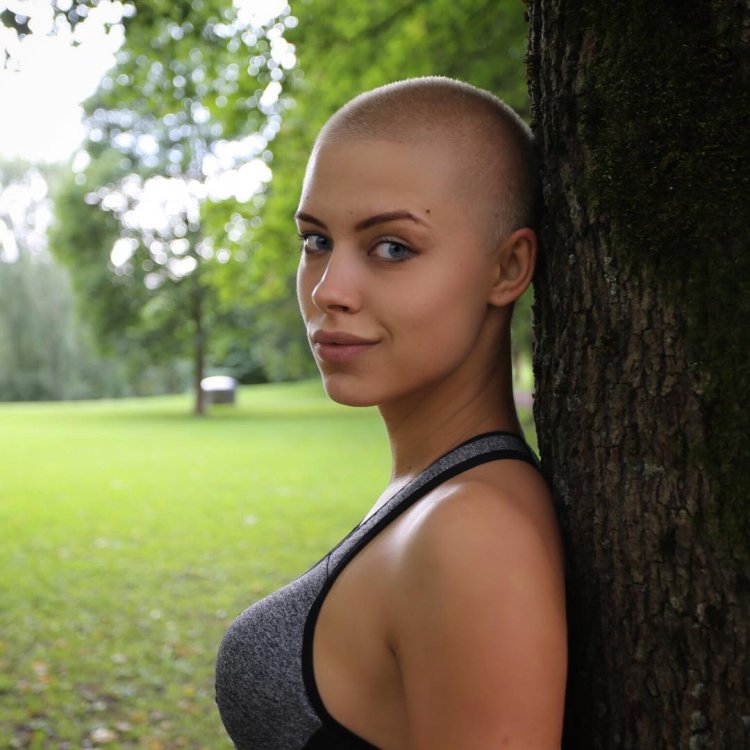Snezhana Samokhina is bald