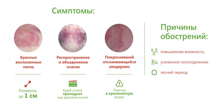 Skin mycoses Classification