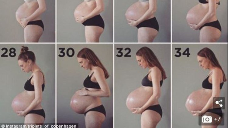 Pregnant Progression