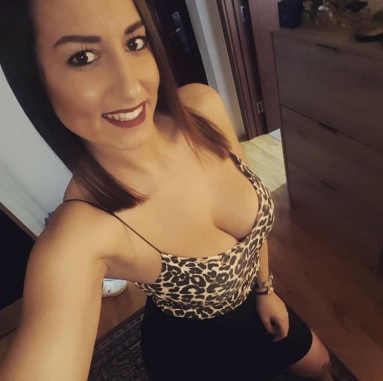 Suzi gala plastic surgery