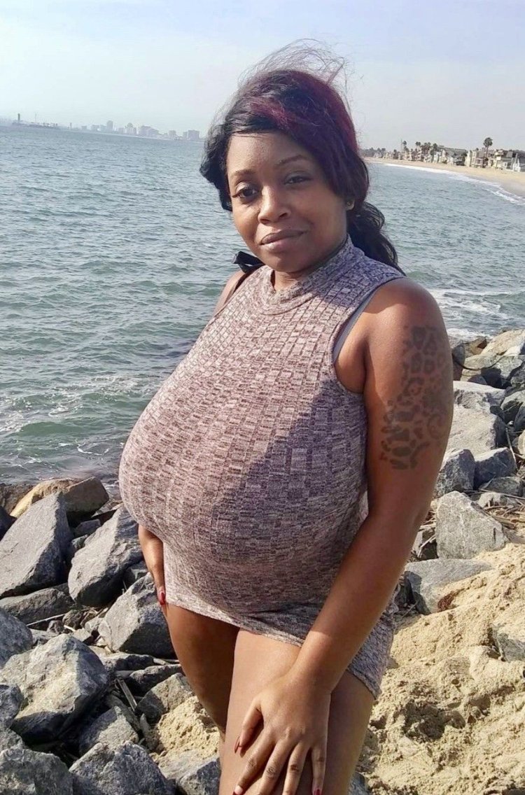 Macromastia in a swimsuit