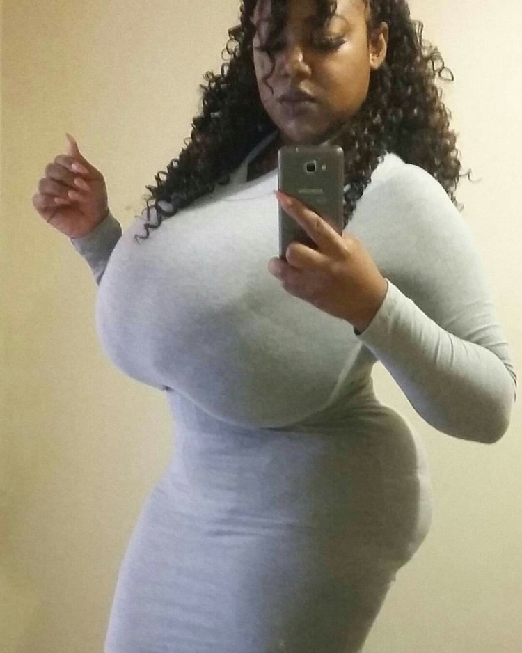 Huge macromastia of pushes