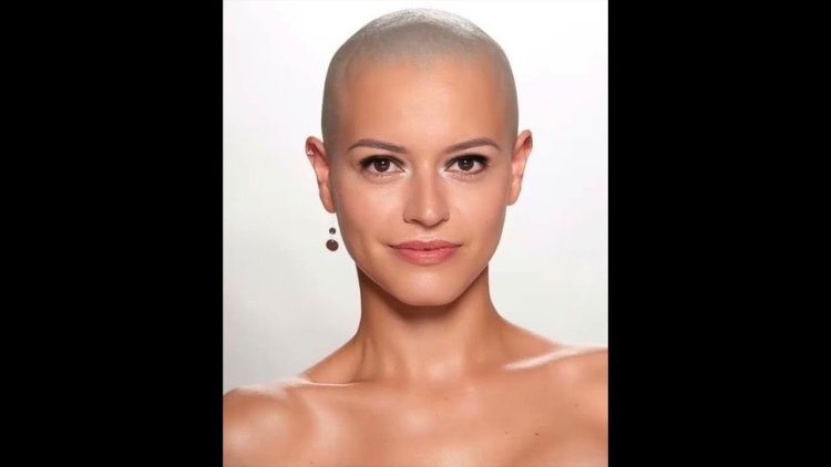 Bald girls