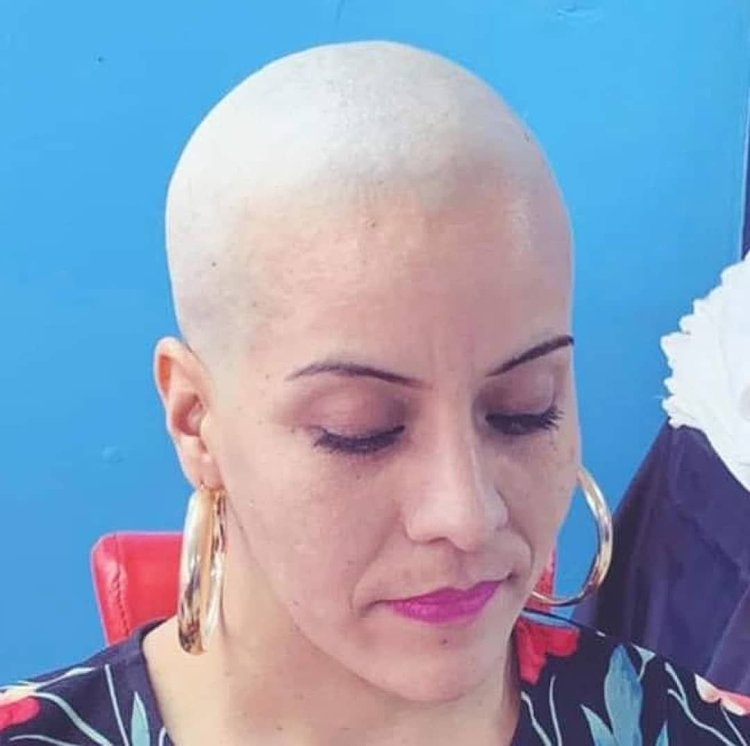 Bald girl psychologist