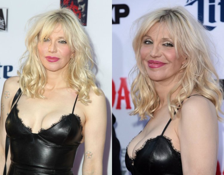 Courtney Love before and after plastic