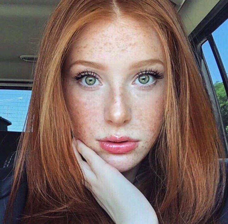 Madelin Ford with freckles