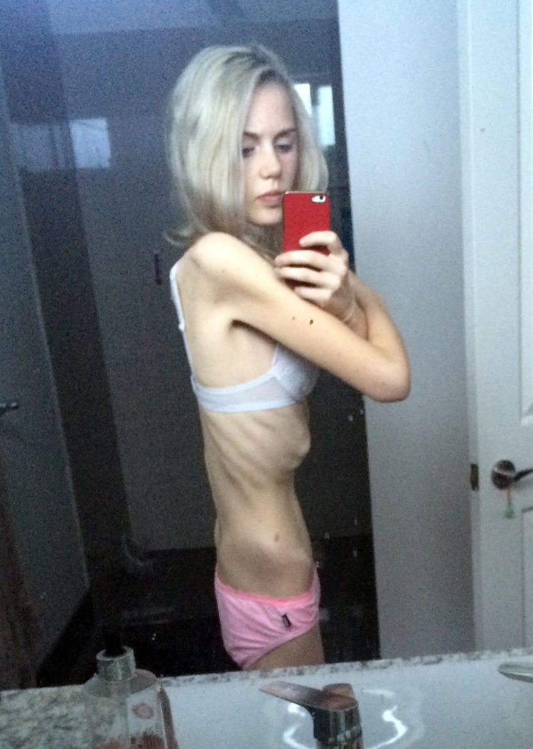 Selfies Girls with anorexia