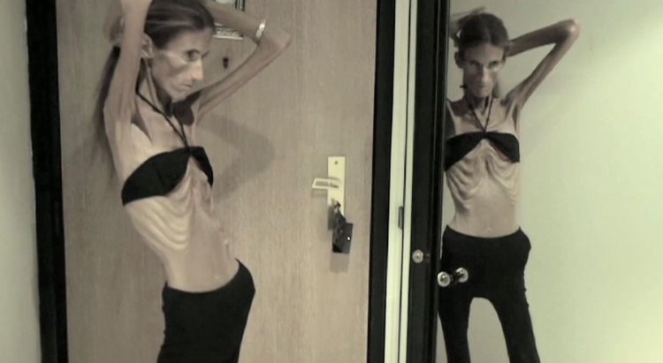 Lina Yegevskaya anorexia