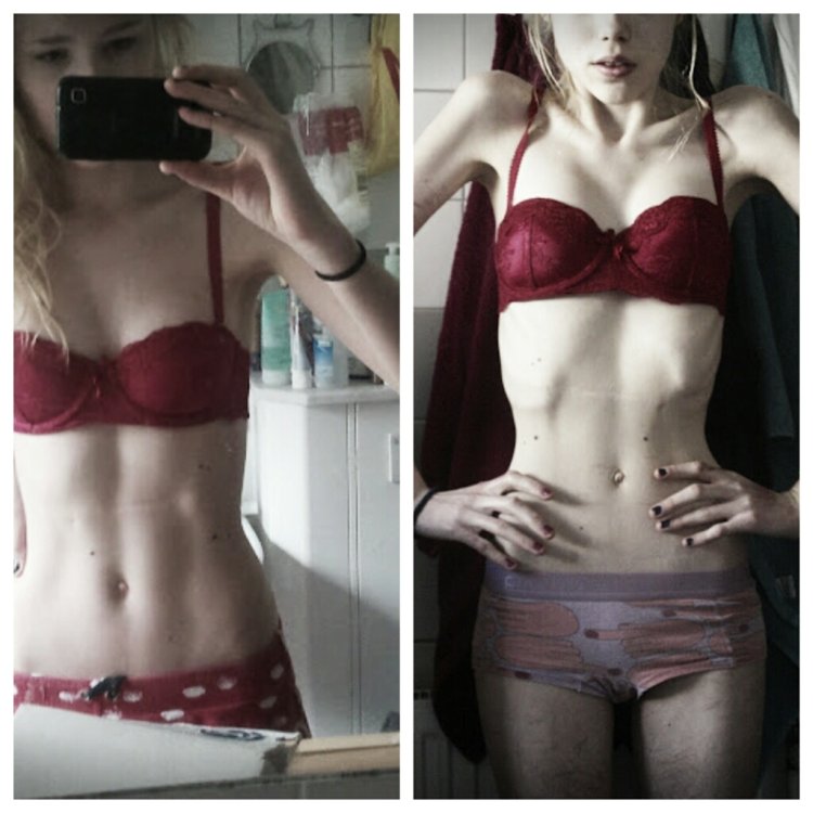 Anorexia motivation