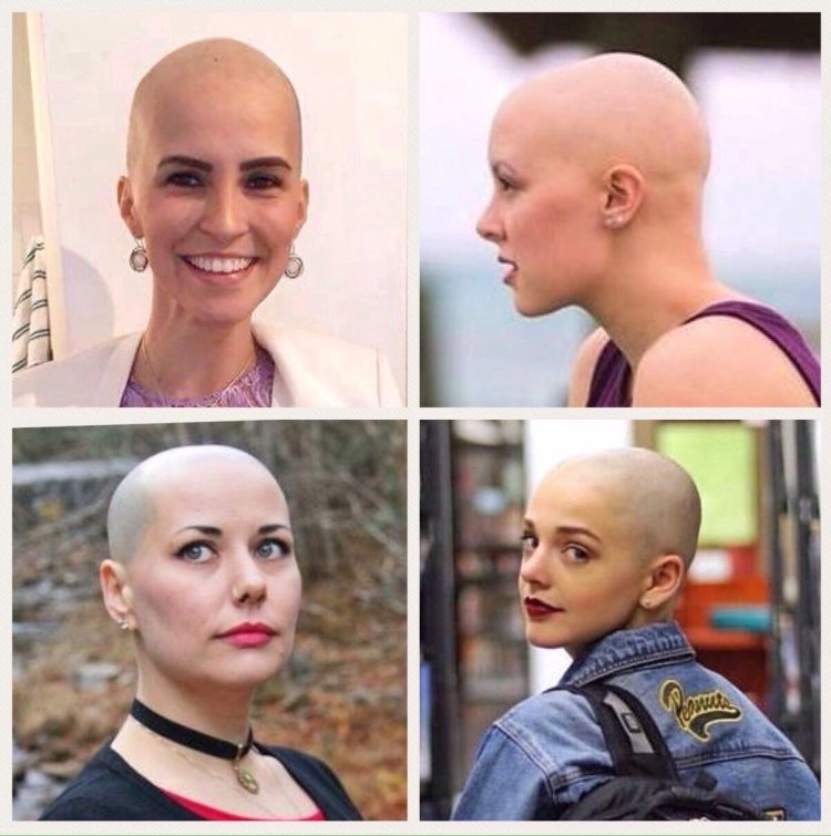 Images of women with a bald head