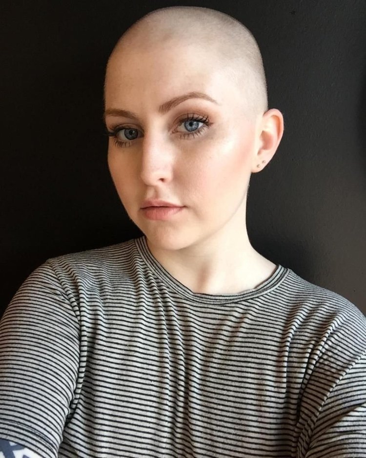 Anne Hathaway shaved bald