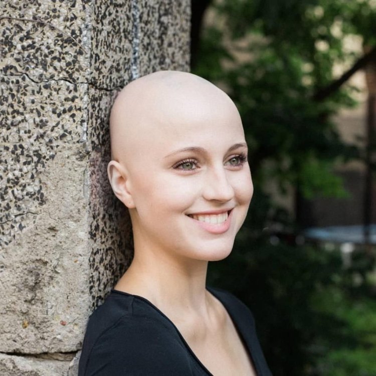 Jesse Jay Carried out bald