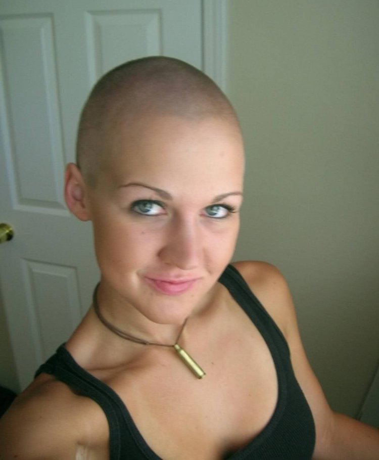 Mia Boyko is bald