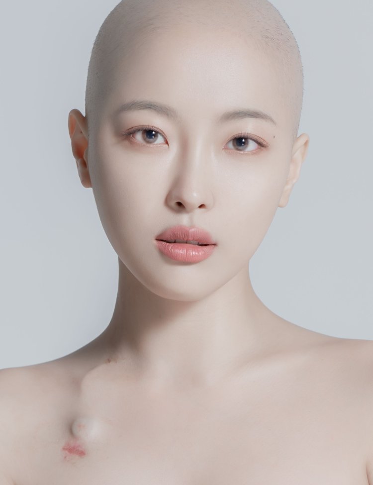 A bald girl portrait