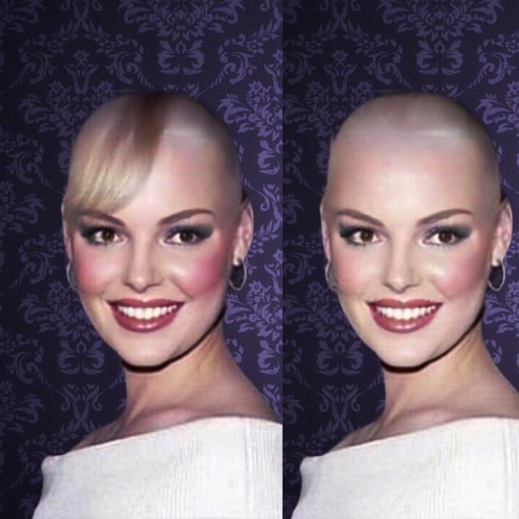 Bald woman