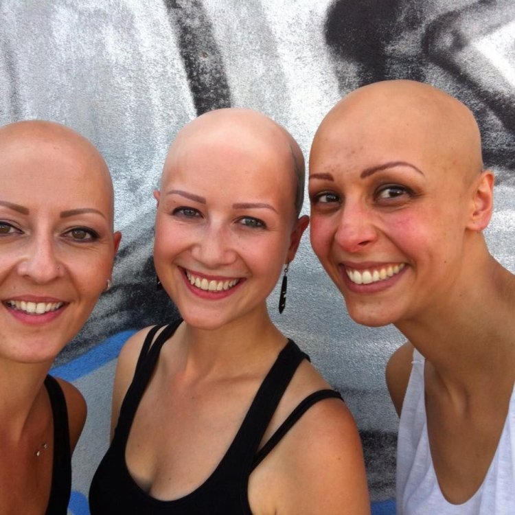 Bald with two girls