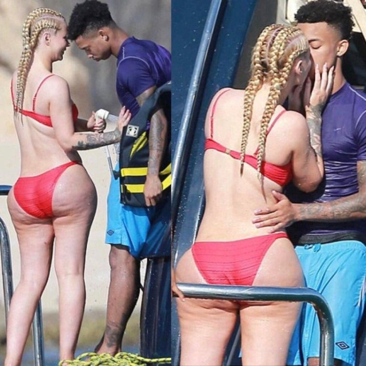 Iggi Azalia cellulite