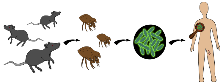 Bubon plague infection