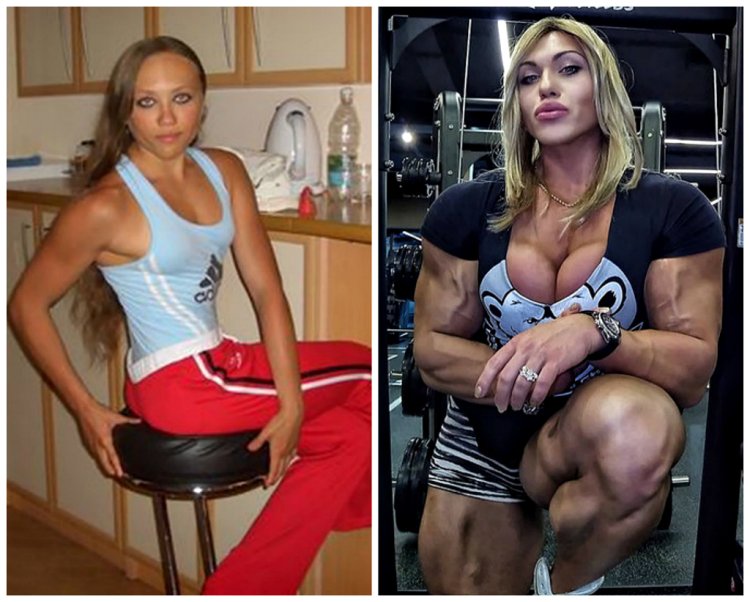Natalya Trukhina Kuznetsova before and after