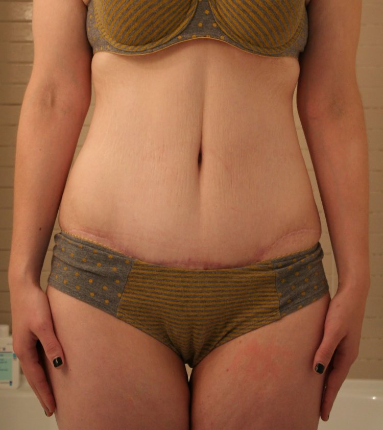 Dragon inflation belly