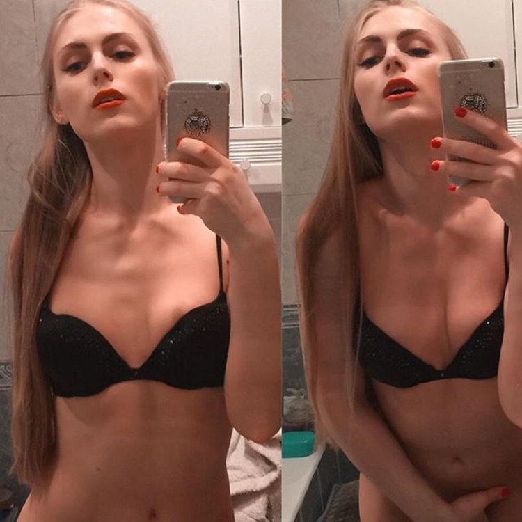 Kira Sadovaya trans after surgery