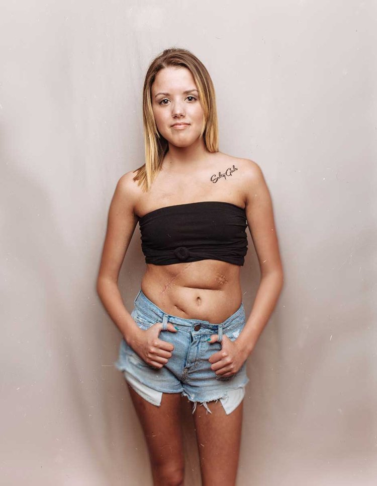 Girl topless Flat chested