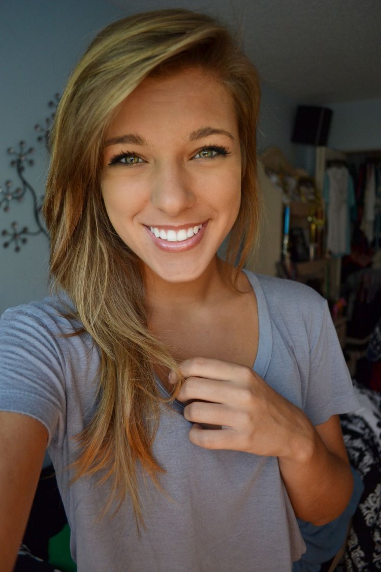 Braces blonde