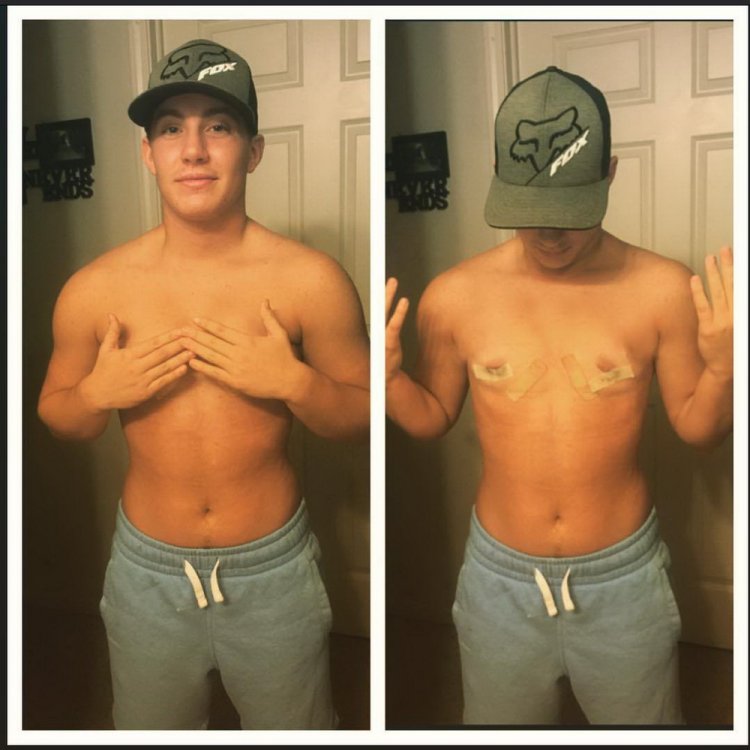 Jamie Wilson before and after