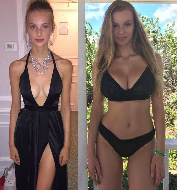 Chloe Vialaret before and after