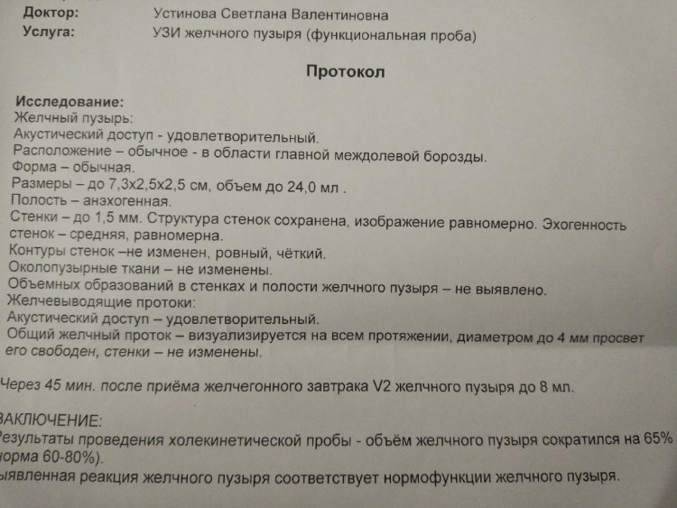 Ultrasound of the gallbladder with a functional test Protocol