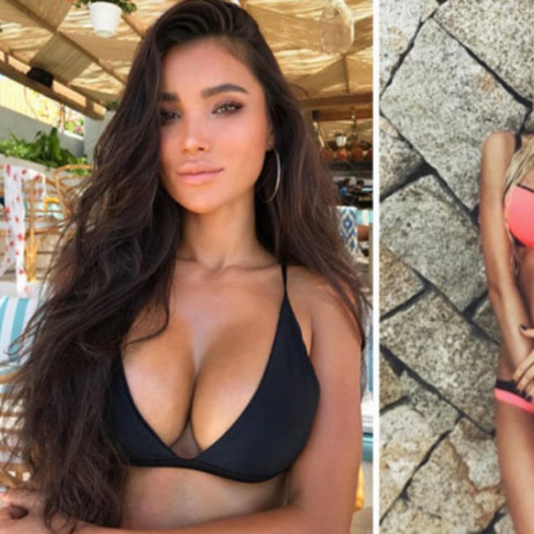 Viki Odintcova before after Surgery