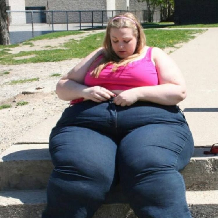 Fat cellulite woman