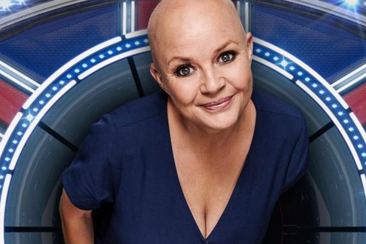 Gail Porter went bald
