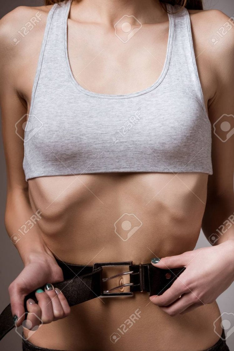 Anorexia belt