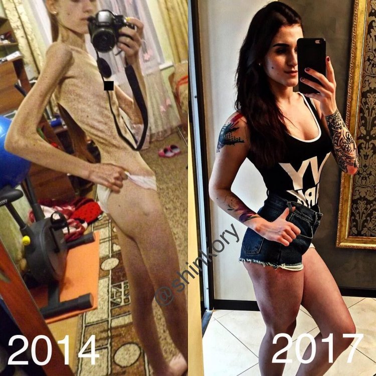 Fitness trainer anorexia