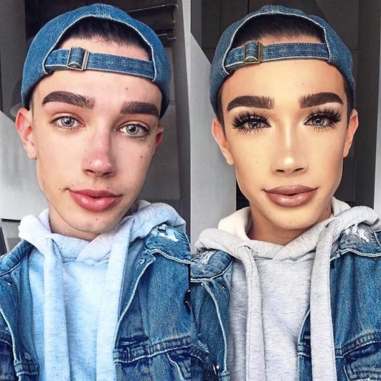 James Charles before plastic surgery