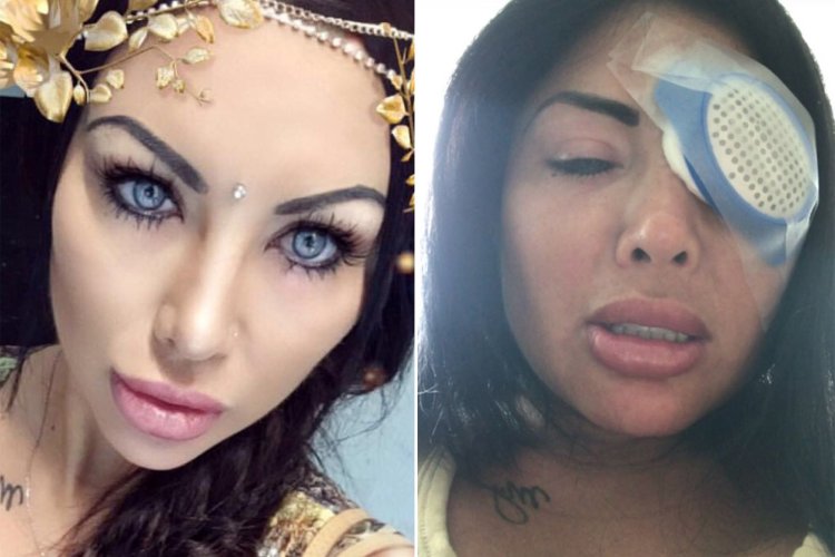 Nadinne Bruna operation