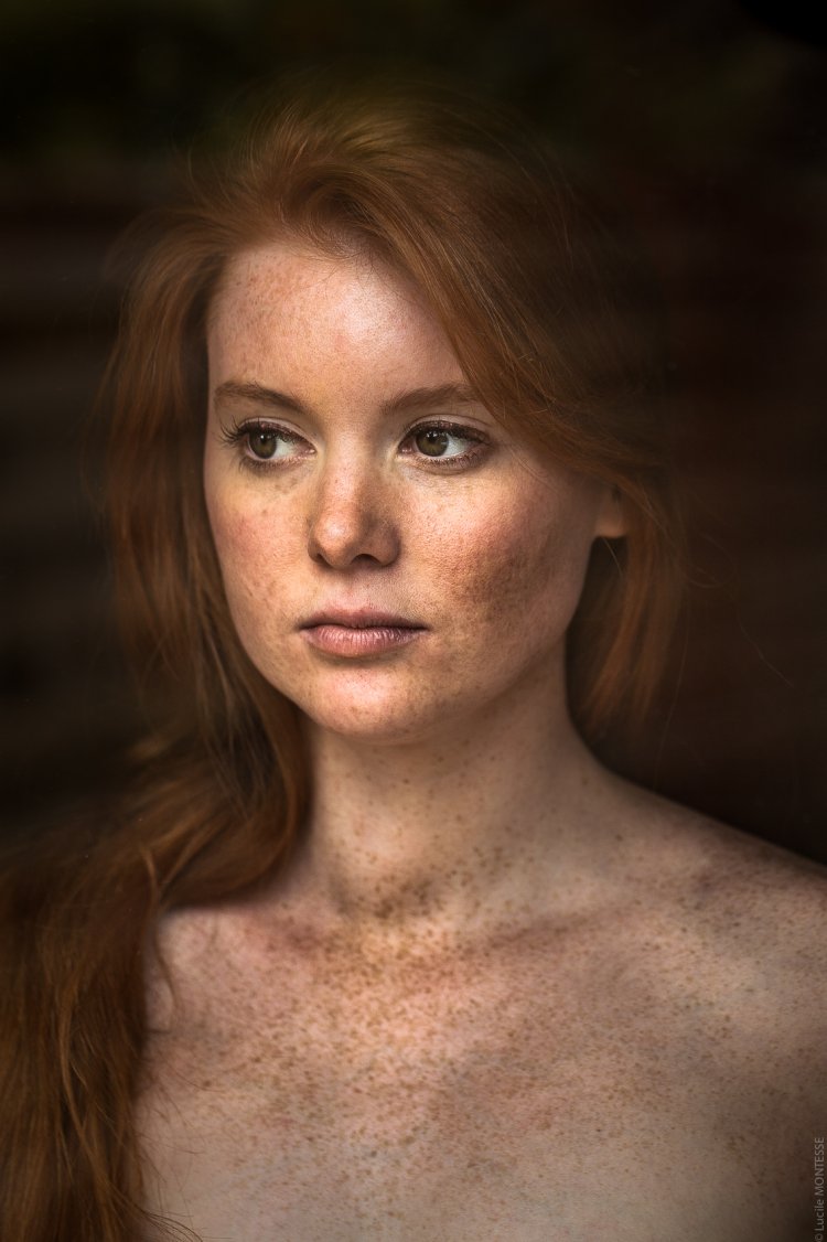 Freckles on the girl's body