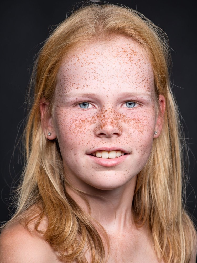 Tween Freckles