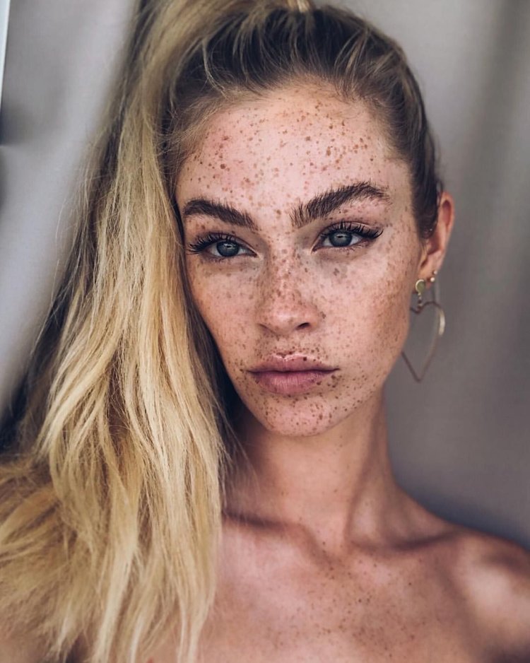 Freckles Loreal Spray