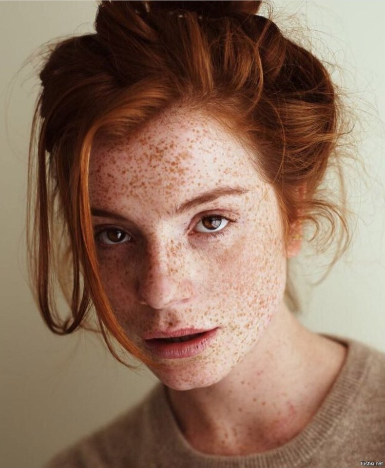 Selina Skinder Freckles